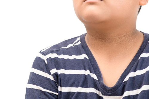 Boys neck with discoloration
