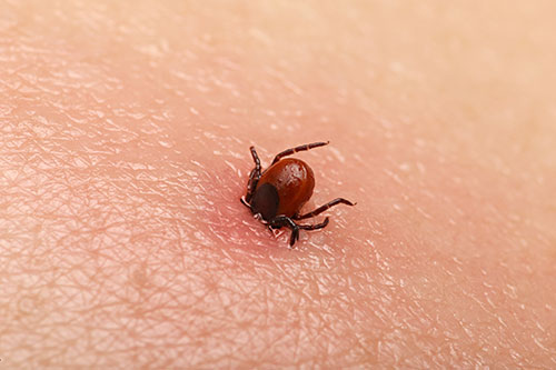 tick in skin