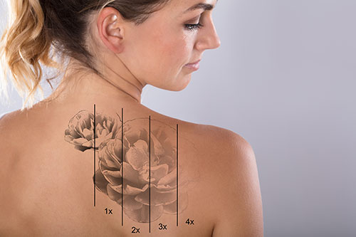 Woman with tattoo on her back
